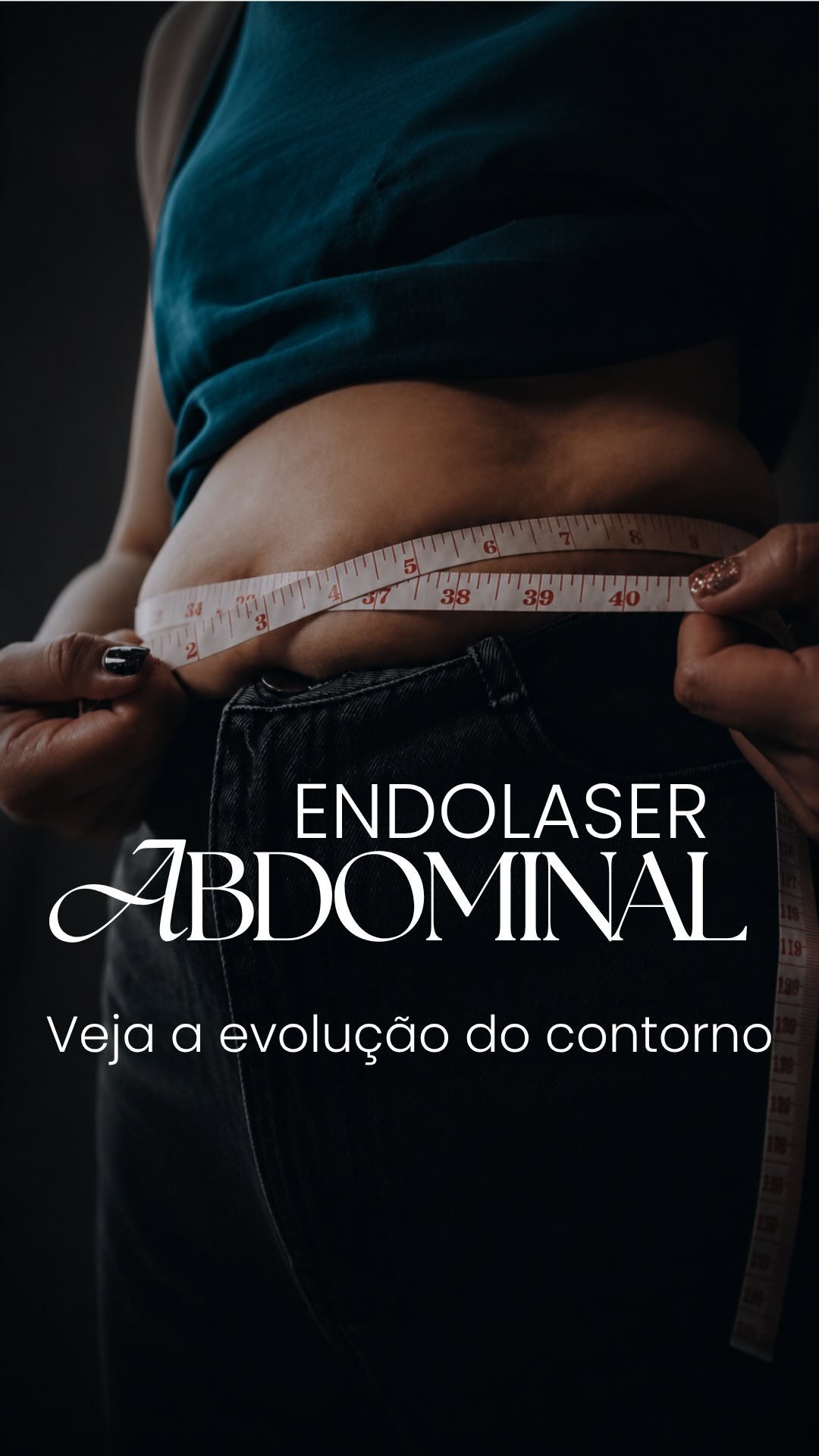 Capa de publicação sobre endolaser abdominal